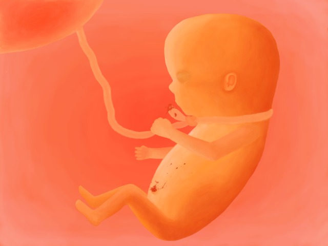 Miscarriage by DiamonDie/foobug^Numedia Cyclops